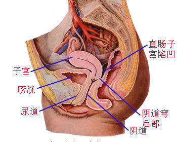 杨陵妇科专家详解如何治疗盆腔脓肿