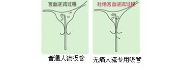 杨陵哪家医院做流产好?