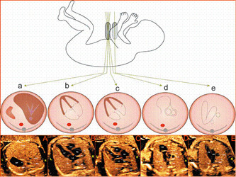 胎儿超声心动图_杨陵西宝妇产医院